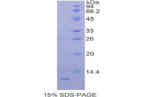 SDS-PAGE analysis of Human PRAME Protein. (PRAME Protein)