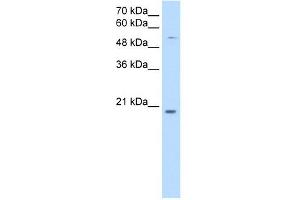 CHIC2 antibody used at 0. (CHIC2 Antikörper  (N-Term))