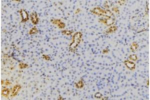 ABIN6279731 at 1/100 staining Mouse kidney tissue by IHC-P. (RAB22A Antikörper  (C-Term))