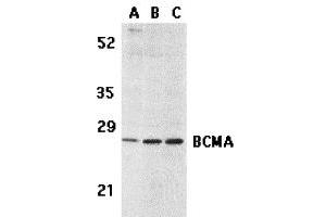 Western Blotting (WB) image for anti-Tumor Necrosis Factor Receptor Superfamily, Member 17 (TNFRSF17) (C-Term) antibody (ABIN1030288) (BCMA Antikörper  (C-Term))