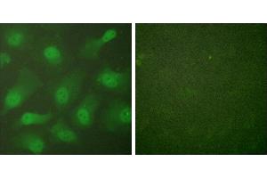 Forskolin + -Immunofluorescence analysis of HeLa cells, treated with Forskolin (40nM, 30mins), using CSantibody.