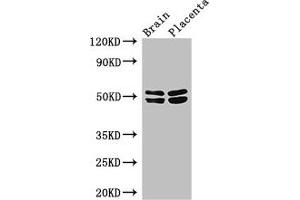 Western Blot Positive WB detected in: Mouse brain tissue, Human placenta tissue All lanes: ADRB1 antibody at 3 μg/mL Secondary Goat polyclonal to rabbit IgG at 1/50000 dilution Predicted band size: 52 kDa Observed band size: 52, 48 kDa (ADRB1 Antikörper  (AA 401-477))