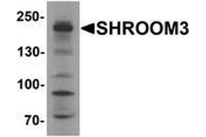 Western blot analysis of SHROOM3 in SK-N-SH cell lysate with SHROOM3 Antibody at 1 μg/ml (SHROOM3 Antikörper  (Middle Region))