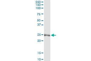 Immunoprecipitation of NME5 transfected lysate using anti-NME5 MaxPab rabbit polyclonal antibody and Protein A Magnetic Bead , and immunoblotted with NME5 purified MaxPab mouse polyclonal antibody (B01P) . (NME5 Antikörper  (AA 1-212))