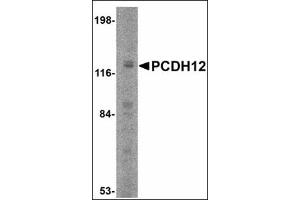 Western blot analysis of PCDH12 in K562 cell lysate with PCDH12 antibody at 2 µg/ml. (PCDH12 Antikörper  (N-Term))