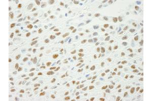 Immunohistochemistry (IHC) image for anti-X-Ray Repair Complementing Defective Repair in Chinese Hamster Cells 1 (XRCC1) (pSer461) antibody (ABIN7448870)
