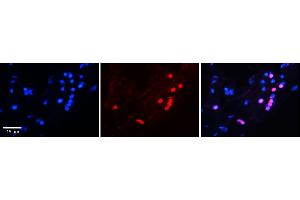 Rabbit Anti-FOXA1 antibody  Catalog Number: ARP32630_P050 Formalin Fixed Paraffin Embedded Tissue: Human Adult heart  Observed Staining: Nuclei in adipocytes but not in cardiomyocytes Primary Antibody Concentration: 1:100 Secondary Antibody: Donkey anti-Rabbit-Cy2/3 Secondary Antibody Concentration: 1:200 Magnification: 20X Exposure Time: 0.