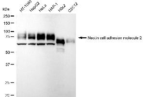 Western blotting analysis using Nectin cell adhesion molecule 2 antibody (ABIN7799565). (Rekombinanter Nectin-2 Antikörper)
