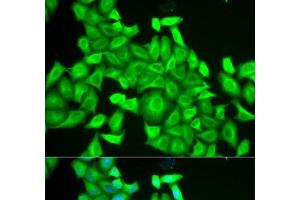 Immunofluorescence analysis of HeLa cells using RAB6A Polyclonal Antibody (RAB6A Antikörper)