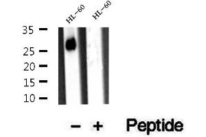 Western blot analysis of extracts of HL-60 cells, using ARHGDIB antibody.