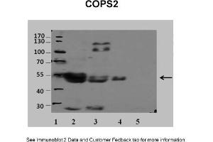 Sample Type: 1. (COPS2 Antikörper  (N-Term))