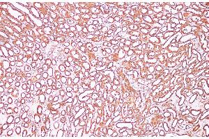 Immunohistochemistry of paraffin-embedded Human kidney using CDK4 Polyclonal Antibody at dilution of 1:100 (CDK4 Antikörper)