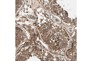 Immunohistochemical staining (Formalin-fixed paraffin-embedded sections) of human testis with FKBP15 polyclonal antibody  shows strong cytoplasmic positivity in cells in seminiferous ducts and Leydig cells. (FKBP15 Antikörper)