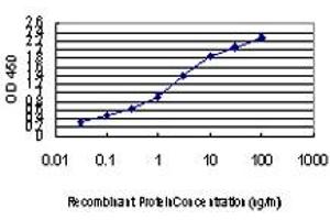 Detection limit for recombinant GST tagged PIK3R4 is approximately 0. (PIK3R4 Antikörper  (AA 1259-1358))
