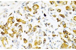 Immunohistochemistry (Paraffin-embedded Sections) (IHC (p)) image for anti-TAP Binding Protein (Tapasin) (TAPBP) antibody (ABIN7260003)