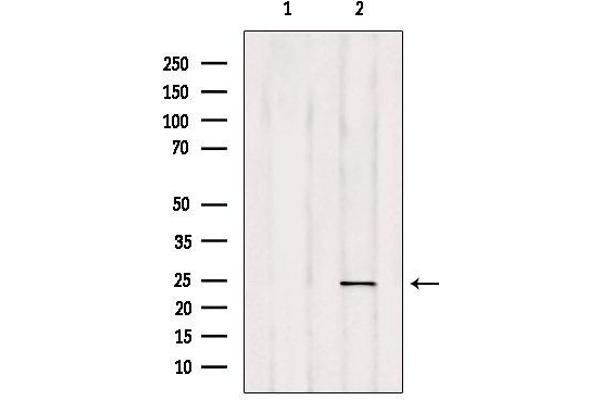 RAB35 Antikörper  (Internal Region)