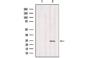 Western blot analysis of extracts from HepG2, using RAB35 Antibody. (RAB35 Antikörper  (Internal Region))