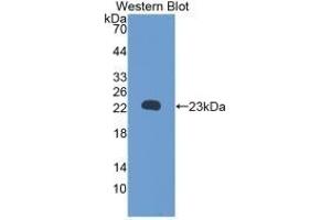 Detection of Recombinant RBP5, Rat using Monoclonal Antibody to Retinol Binding Protein 5, Cellular (RBP5) (Retinol Binding Protein 5 Antikörper  (AA 19-201))