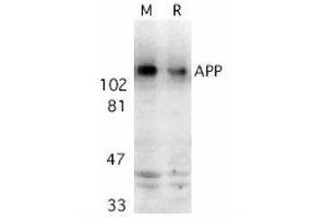 Image no. 1 for anti-Amyloid beta (A4) Precursor Protein (APP) (AA 737-751) antibody (ABIN319013) (APP Antikörper  (AA 737-751))