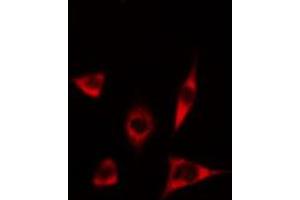 ABIN6274634 staining Hela cells by IF/ICC. (CYP17A1 Antikörper  (Internal Region))