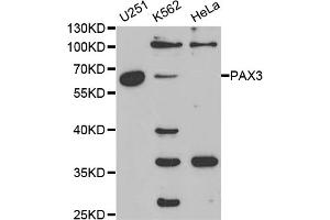 Western blot analysis of extracts of various cell lines, using PAX3 antibody (ABIN5970834) at 1/1000 dilution. (Paired Box 3 Antikörper)