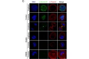 Bufalin prevents Aurora A recruitment to mitotic centrosomes and Aurora B recruitment to unattached kinetochores(A) HeLa cells were synchronized by a single thymidine treatment, released in the presence or absence of bufalin (100 nM) for 9 h, and stained for phospho-Aurora A (Green), α-tubulin (Red) and DNA (Blue). (Aurora Kinase B Antikörper  (pThr232))