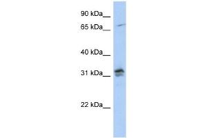 H1FOO antibody used at 1 ug/ml to detect target protein. (H1FOO Antikörper  (N-Term))