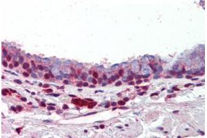 Human Lung, Respiratory Epithelium (formalin-fixed, paraffin-embedded) stained with PRMT1 antibody ABIN462306 followed by biotinylated goat anti-rabbit IgG secondary antibody ABIN481713, alkaline phosphatase-streptavidin and chromogen. (PRMT1 Antikörper  (AA 317-346))