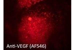 Immunostaining of primary RPE cells using VEGFAAb at 1/50 dilution, (VEGFA Antikörper  (Isoform 6))