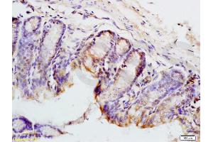 Formalin-fixed and mouse colon tissue labeled with Anti-PAX9 Polyclonal Antibody, Unconjugated (ABIN737691) at 1:200 followed by conjugation to the secondary antibody and DAB staining (PAX9 Antikörper  (AA 271-341))