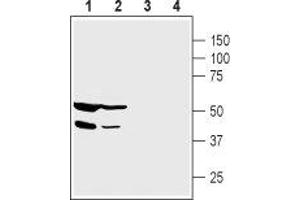 Western blot analysis of human  pancreatic carcinoma cell lysate (lanes 1 and 3) and human HepG2 liver carcinoma cell lysate (lanes 2 and 4):1,2. (Protein Interacting With Protein Kinase C, alpha 1 (PICK1) Peptid)