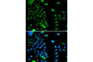 Immunofluorescence analysis of MCF-7 cells using UBE2J2 antibody. (UBE2J2 Antikörper)