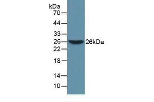 Western blot analysis of recombinant Mouse WARS. (WARS Antikörper  (AA 29-195))
