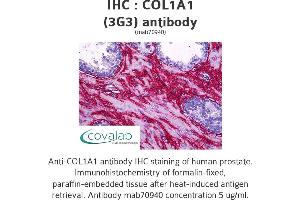 Image no. 2 for anti-Collagen, Type I, alpha 1 (COL1A1) (AA 1021-1108) antibody (ABIN1723789) (COL1A1 Antikörper  (AA 1021-1108))