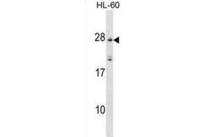 Western Blotting (WB) image for anti-Membrane-Spanning 4-Domains, Subfamily A, Member 5 (MS4A5) antibody (ABIN3000092) (MS4A5 Antikörper)
