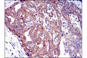Immunohistochemistry (IHC) image for anti-Twinfilin, Actin-Binding Protein 1 (TWF1) (AA 335-384) antibody (ABIN1846307) (TWF1 Antikörper  (AA 335-384))