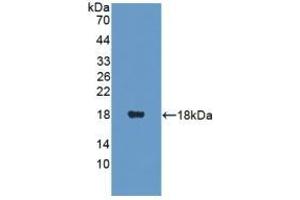 Detection of Recombinant PANK4, Human using Polyclonal Antibody to Pantothenate Kinase 4 (PANK4)