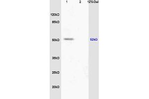 L1 human colon carcinoma lysate L2 mouse embryo lysates probed with Anti phospho-PPAR alpha(Ser12) Polyclonal Antibody, Unconjugated (ABIN753163) at 1:200 overnight at 4 °C. (PPARA Antikörper  (pSer12))