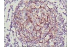 Immunohistochemical analysis of paraffin-embedded human lymph node using NTRK3 antibody with DAB staining.