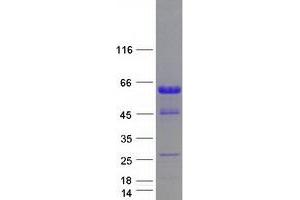 Validation with Western Blot