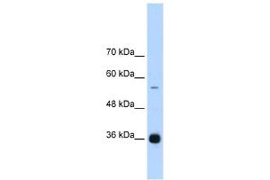 WB Suggested Anti-HNRPAB Antibody Titration:  1. (HNRNPAB Antikörper  (C-Term))