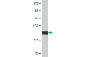 Western Blot detection against Immunogen (37. (HLA-DMB Antikörper  (AA 22-129))