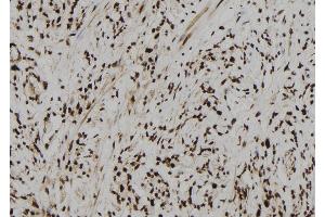 ABIN6261007 and ABIN6273104 at 1/100 staining Human gastric tissue by IHC-P. (CPSF4 Antikörper  (C-Term))