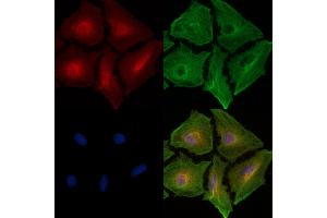 ABIN6256935 and ABIN6274838 staining  cells by IF/ICC.