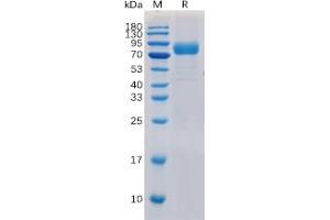 Human CD19 Protein, hFc-His Tag on SDS-PAGE under reducing condition. (CD19 Protein (Fc-His Tag))
