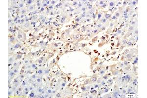 Formalin-fixed and paraffin embedded rat liver labeled with Anti-ARP4 Polyclonal Antibody, Unconjugated (ABIN708581) at 1:200 followed by conjugation to the secondary antibody (BAF53A Antikörper  (AA 331-410))