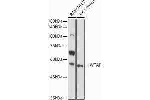 Western blot analysis of extracts of various cell lines, using WTAP antibody (ABIN7271372) at 1:1000 dilution. (WTAP Antikörper  (AA 1-396))