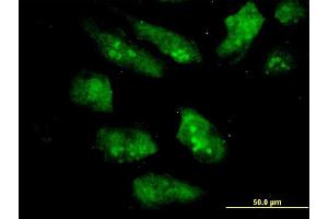 Immunofluorescence of monoclonal antibody to EIF2AK2 on HeLa cell. (EIF2AK2 Antikörper  (AA 1-100))
