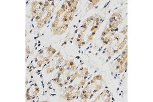 Immunohistochemistry (IHC) image for anti-Small Nuclear Ribonucleoprotein Polypeptide E (SNRPE) antibody (ABIN1876676) (SNRPE Antikörper)