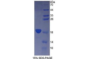Image no. 1 for CD164 (CD164) (AA 24-162) protein (T7 tag,His tag) (ABIN6238714)